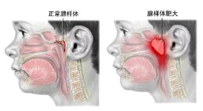 圖片2 圖片2
